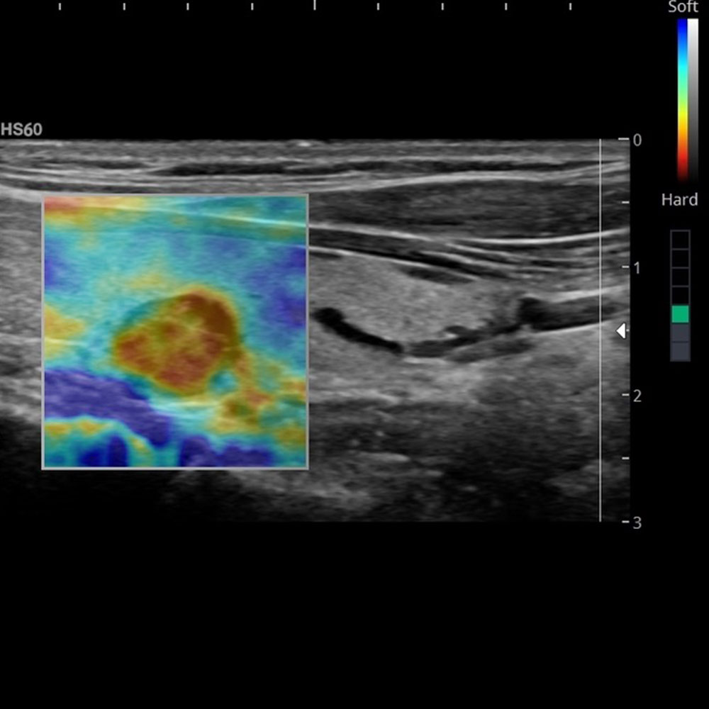 Ultraschall Internisten Metzler und Schöntag in Schwäbisch Gmünd
